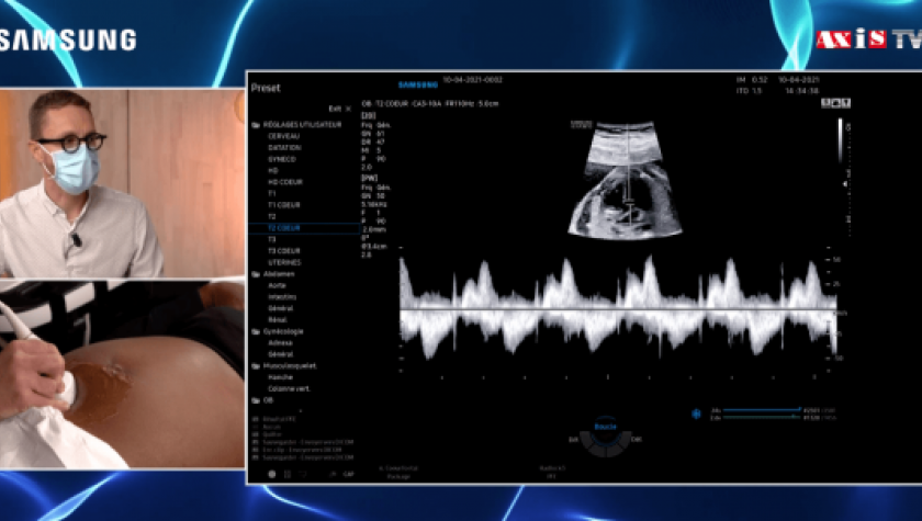 Battement De Examen De Coeur De Foetus De Gynécologue Avec Plaisir Dans  L'hôpital Image stock - Image du grossesse, intérieur: 91236267